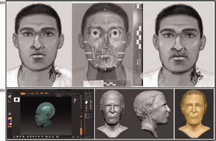 Facial Reconstruction Of Ax Wound