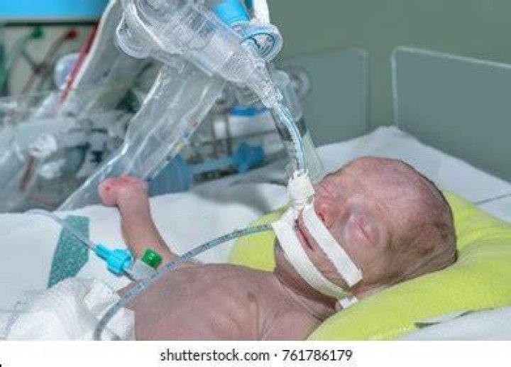 Intubated Newborn