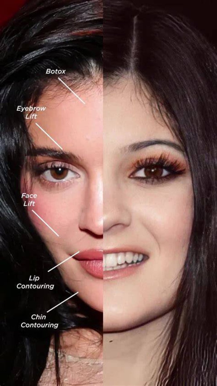 Kylie Jenner’s Changing Face: 10 Instagram Pics That Look Nothing Like Her