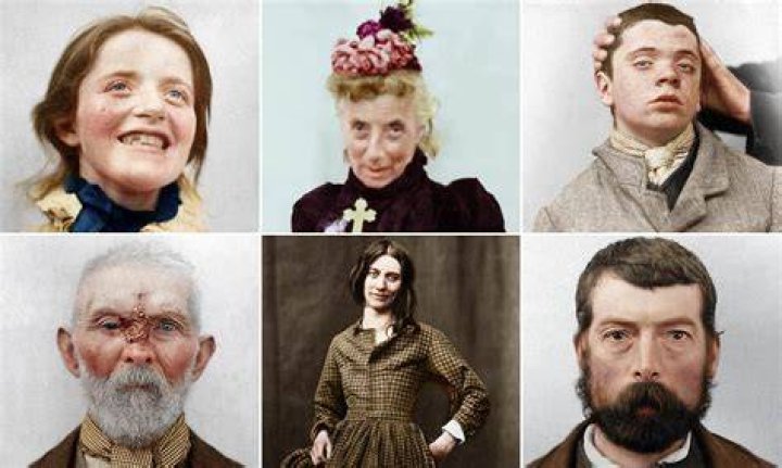 Mental Asylum Portraits