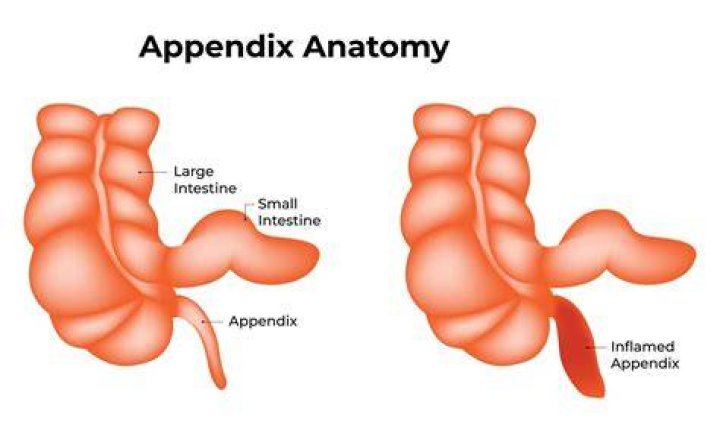 Removed Human Appendix
