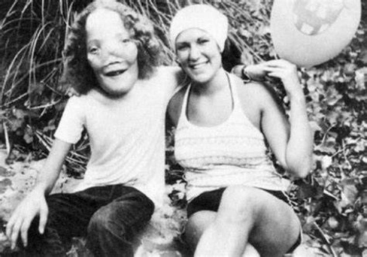 Rocky And Rusty Dennis In Mask
