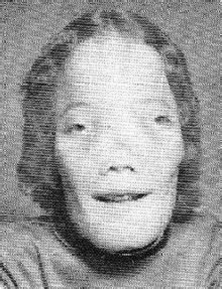 Rocky Dennis In Junior High School