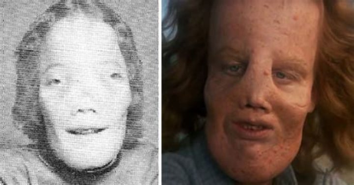 Rocky Dennis In Mask