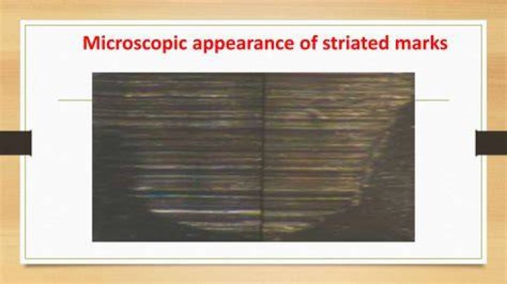 Tool Marks From Earliest Ear Surgery