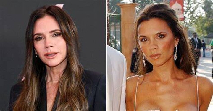 Victoria beckham breast implants removed
